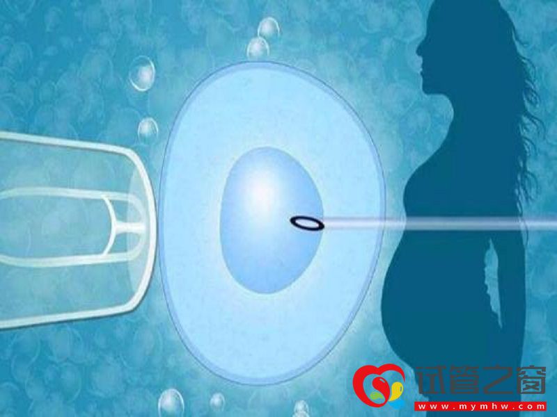 試管一代到四代的特點，局外人也能看懂